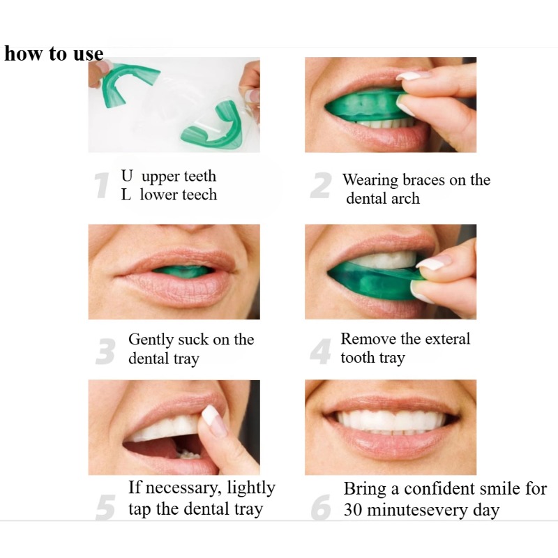 Set Vassoio per sbiancamento d - Teeth Whitening For Trays recensione e prezzo