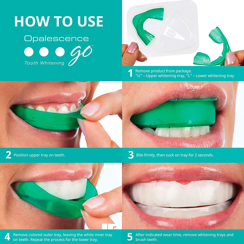 Perossido di idrogeno per sbia - Teeth Whitening With Hydrogen Peroxide recensione e prezzo