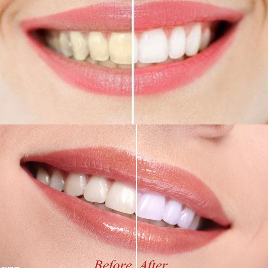 Denti di carbone di bambù dent - Teeth Paint Whitening recensione e prezzo