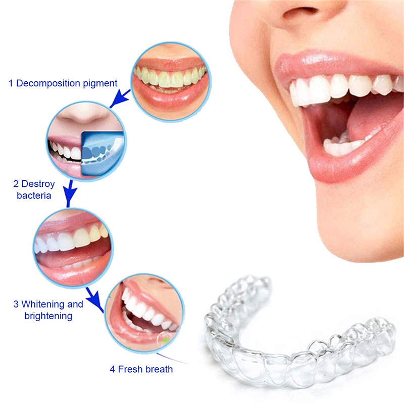 Protezione Notturna in Silicon - Teeth Whitening For Trays recensione e prezzo
