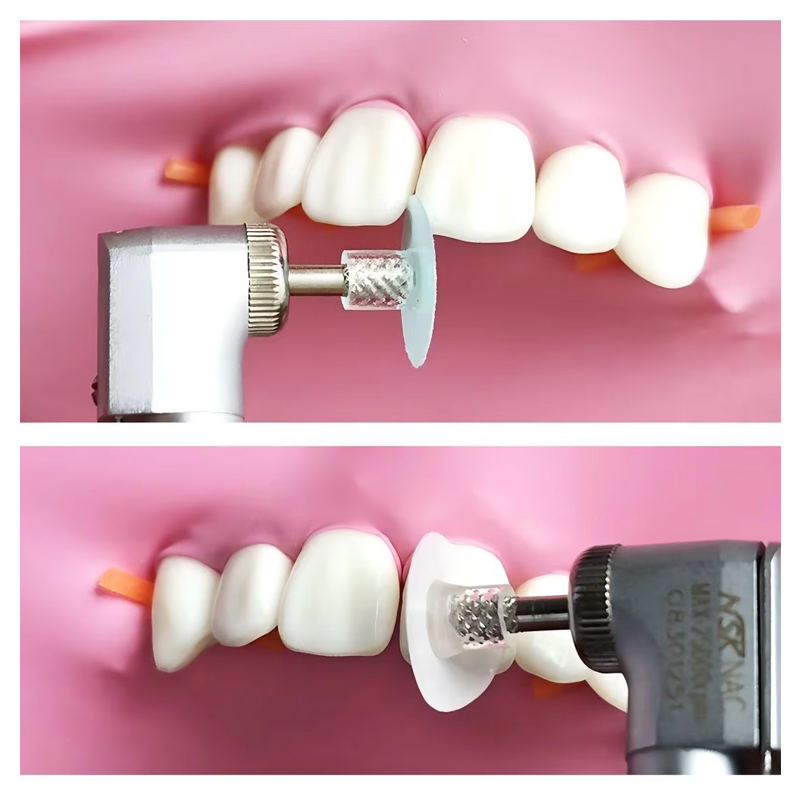 40 Pezzi Dischi Lucidanti Dent - Whitening Teeth Dentist recensione e prezzo