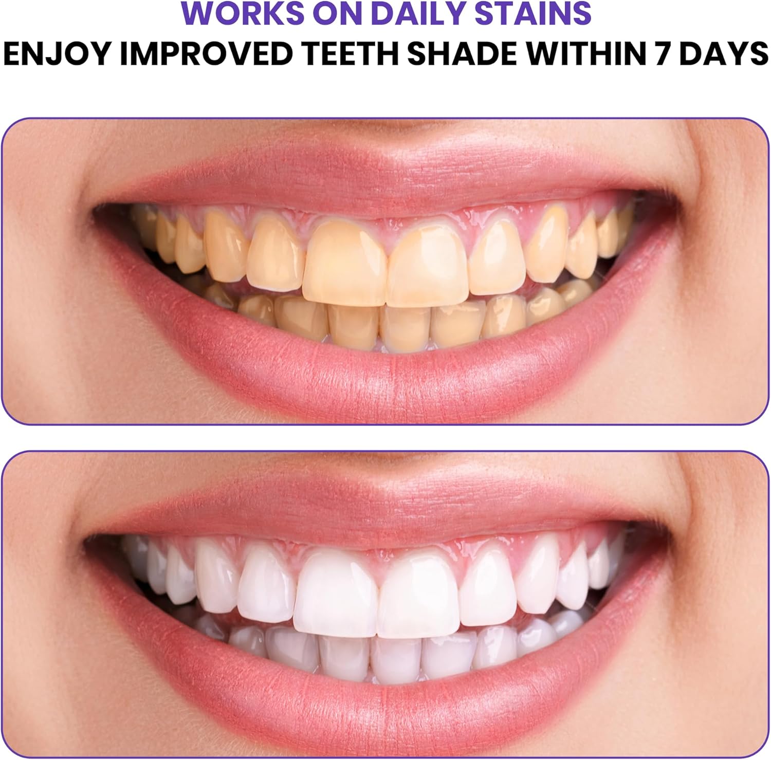 Strisce Sbiancanti Avanzate Vi - Teeth Whitening In Office recensione e prezzo