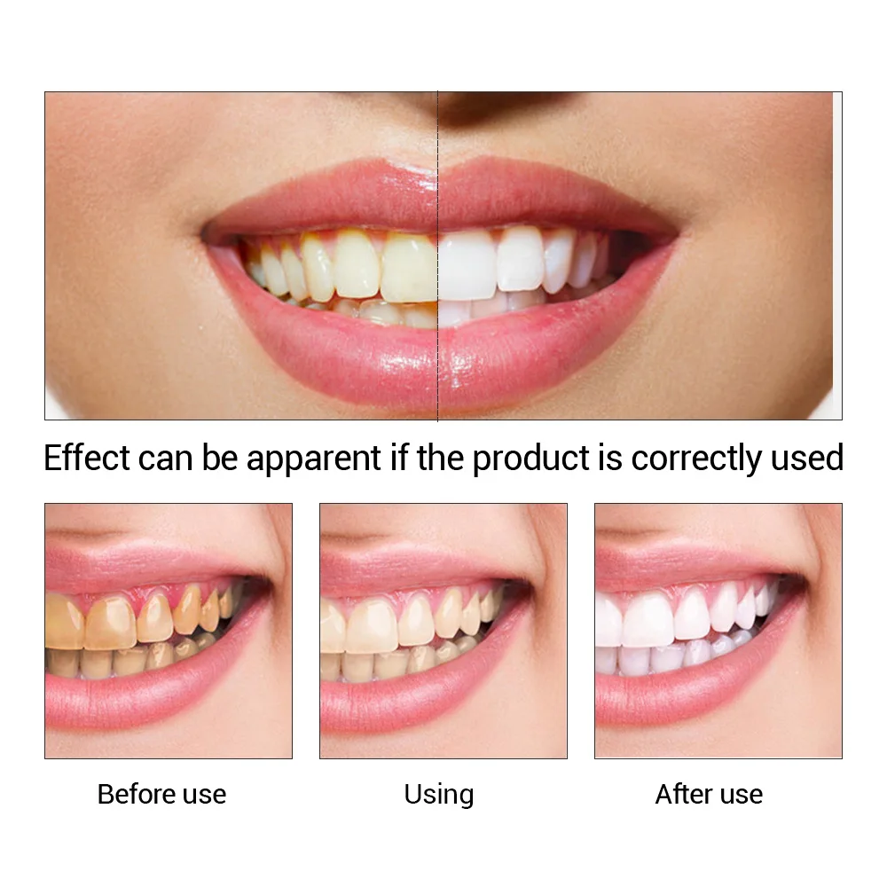 FTEENPLY Sbiancamento Dei Dent - Teeth Paint Whitening recensione e prezzo