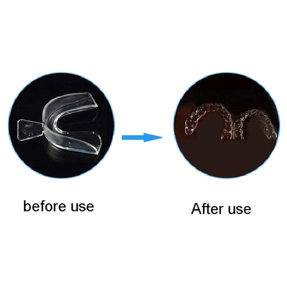 Paradenti in silicone per orto - Teeth Whitening For Trays recensione e prezzo