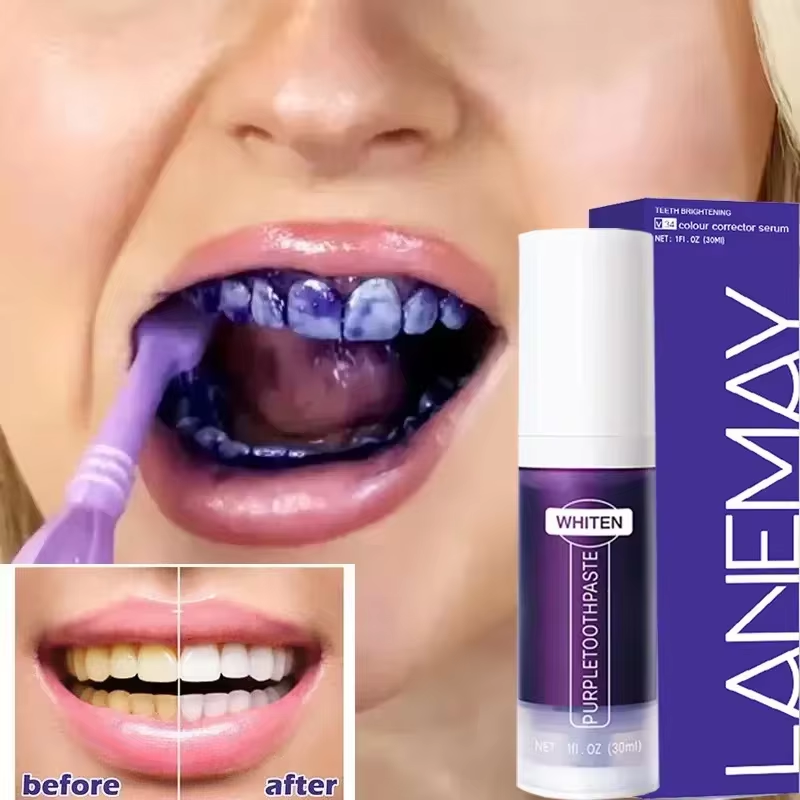 V34 Dentifricio sbiancante per - Teeth Whitening Crest recensione e prezzo