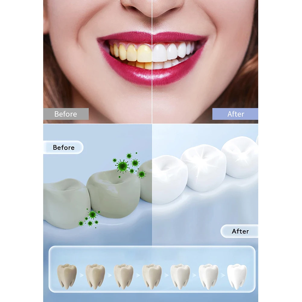 1PC Lampada per sbiancamento d - Teeth Whitening In Office recensione e prezzo