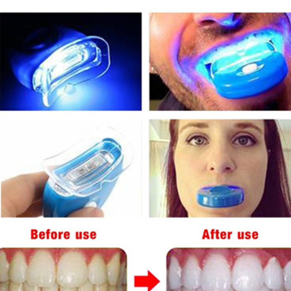 Nuovo Led blu sbiancamento dei - Teeth Whitening In Office recensione e prezzo