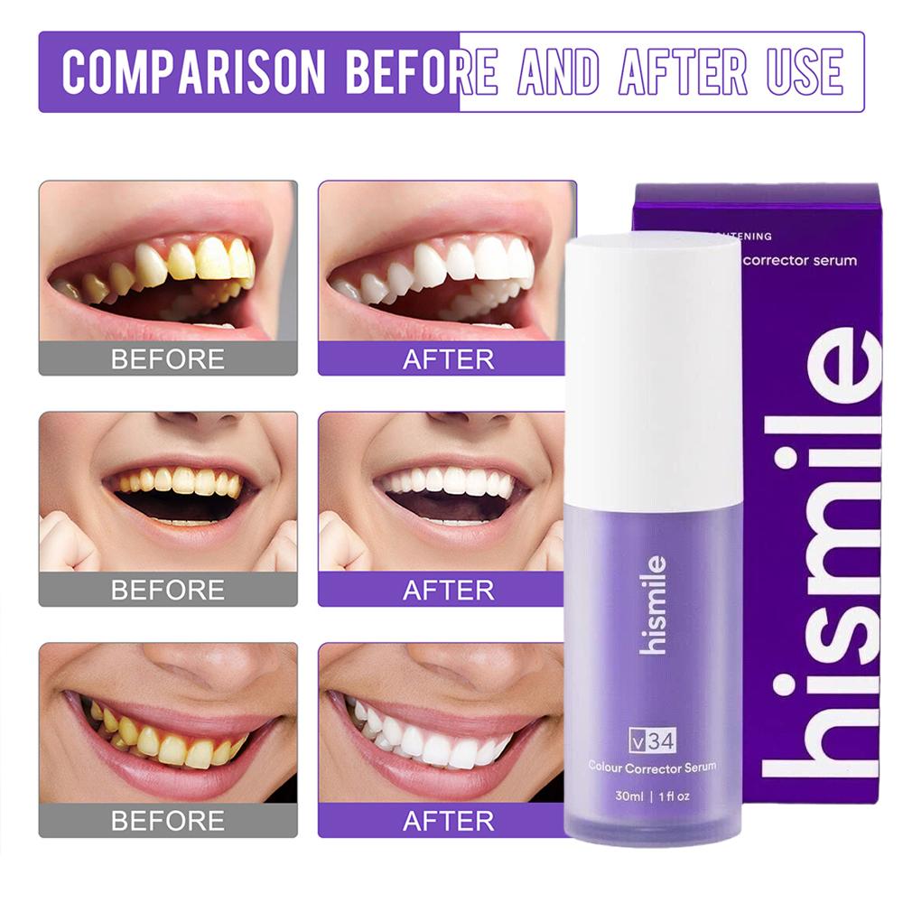 Siero Correttivo per il Colore - Teeth Whitening Crest recensione e prezzo