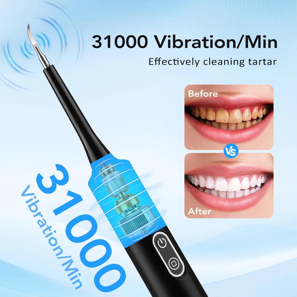 Scalatore Dentale Elettrico a  - Whitening Teeth Dentist recensione e prezzo