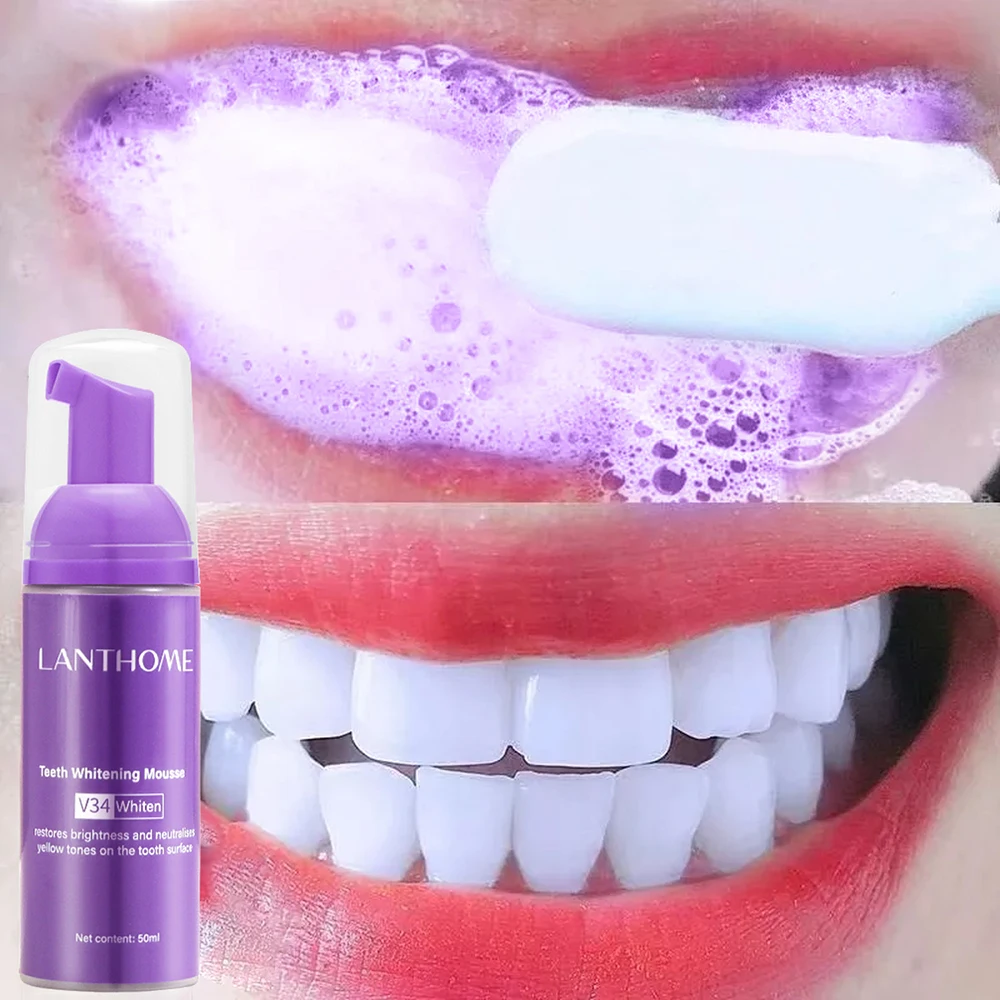 Mousse V34 dentifricio pulizia - Teeth Whitening Crest recensione e prezzo